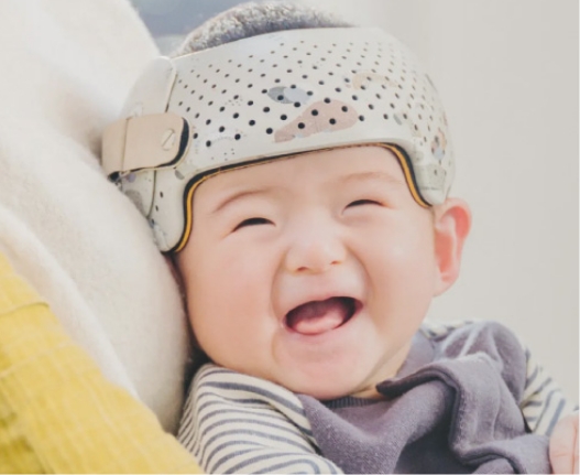 頭のかたち：画像